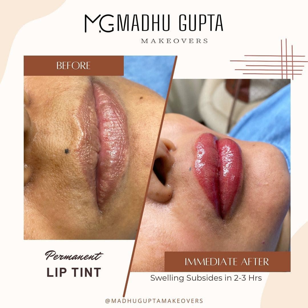 Permanent Lip Coloring