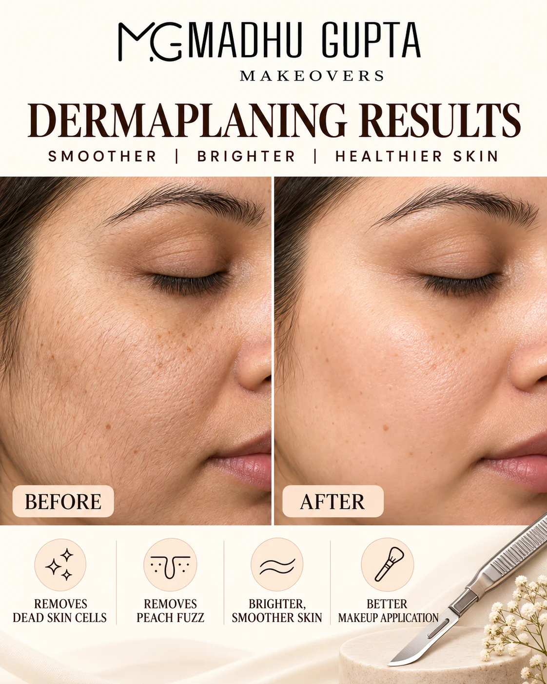 Dermaplaning results before and after at MG Makeovers: smoother, brighter skin