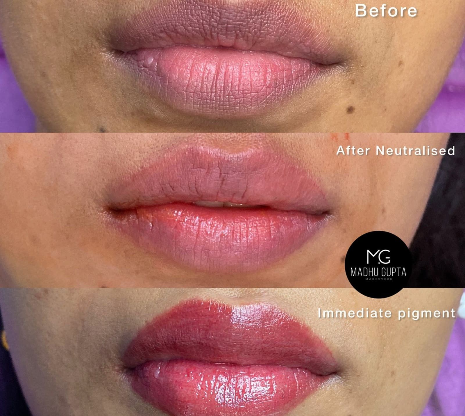 The Secret of Permanent Lip Coloring/Blush and Lip Neutralization