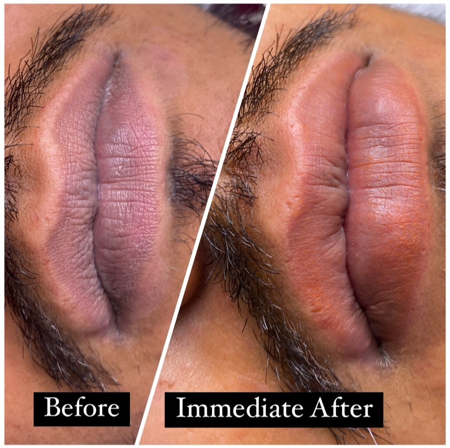 Smoker Lip Colour Correction by MG Makeover