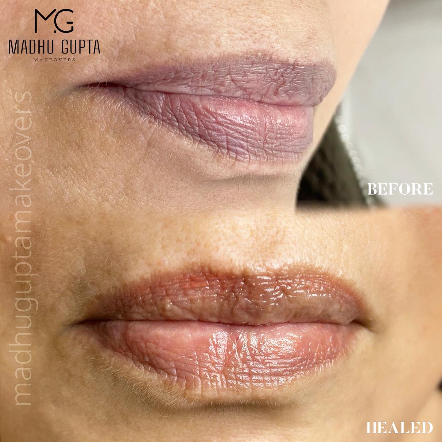 MG Makeover's Lip Color Neutralization