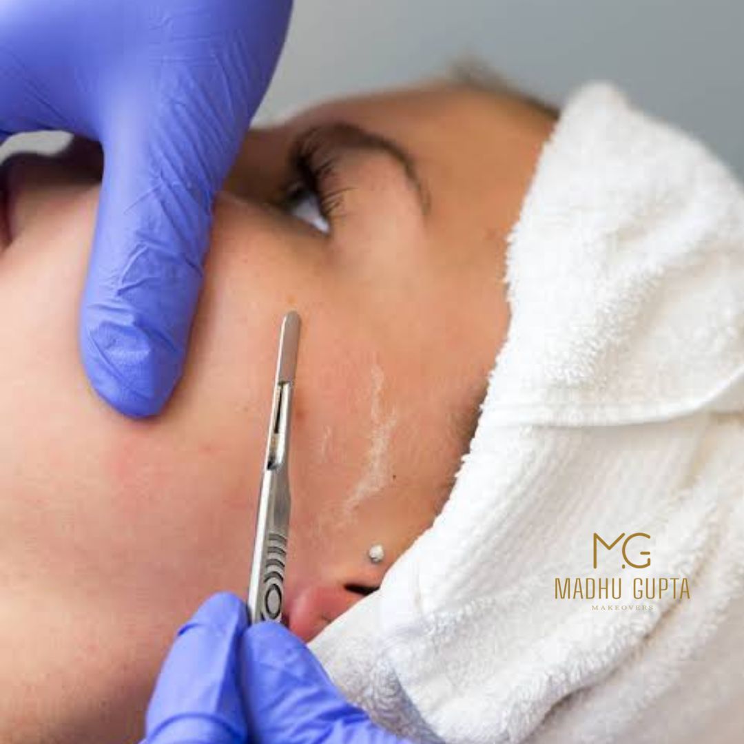 Dermaplaning at MG Makeovers