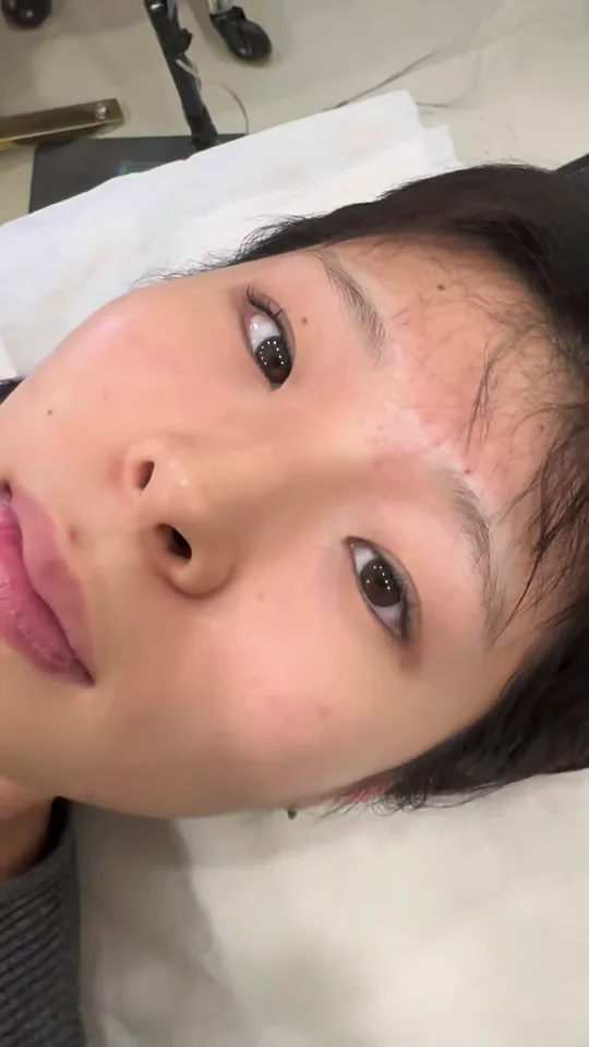 日本人のお客様のまつげパーマ