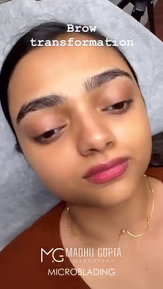 Brow Transformation